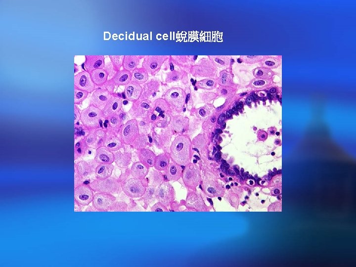 Decidual cell蛻膜細胞 