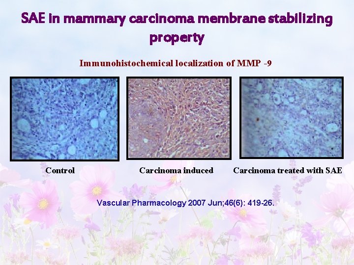 SAE in mammary carcinoma membrane stabilizing property Immunohistochemical localization of MMP 9 Control Carcinoma