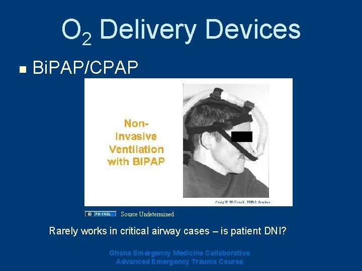 O 2 Delivery Devices n Bi. PAP/CPAP Source Undetermined Rarely works in critical airway O 2 Delivery Devices n Bi. PAP/CPAP Source Undetermined Rarely works in critical airway