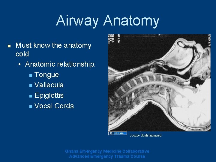 Airway Anatomy n Must know the anatomy cold • Anatomic relationship: n Tongue n Airway Anatomy n Must know the anatomy cold • Anatomic relationship: n Tongue n
