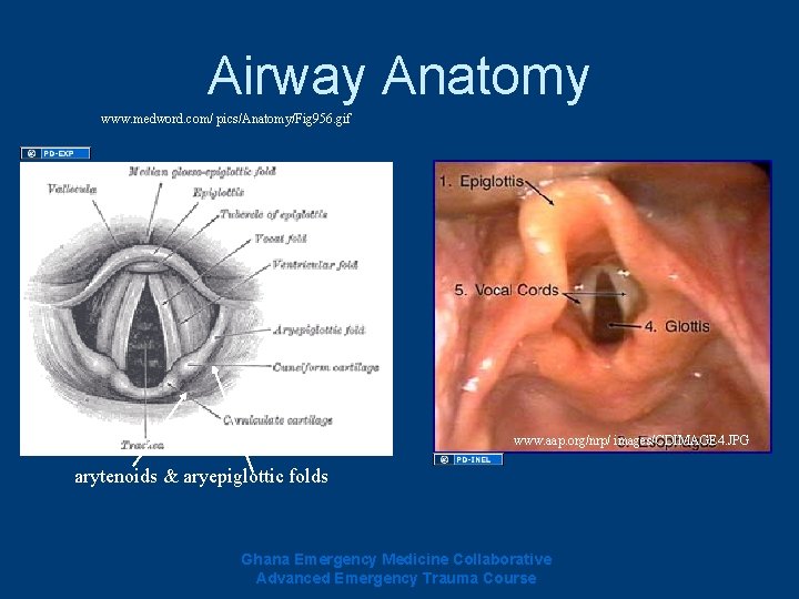 Airway Anatomy www. medword. com/ pics/Anatomy/Fig 956. gif www. aap. org/nrp/ images/CDIMAGE 4. JPG Airway Anatomy www. medword. com/ pics/Anatomy/Fig 956. gif www. aap. org/nrp/ images/CDIMAGE 4. JPG