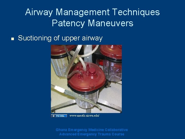 Airway Management Techniques Patency Maneuvers n Suctioning of upper airway www. anesth. uiowa. edu/ Airway Management Techniques Patency Maneuvers n Suctioning of upper airway www. anesth. uiowa. edu/