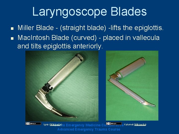 Laryngoscope Blades n n Miller Blade - (straight blade) -lifts the epiglottis. Mac. Intosh Laryngoscope Blades n n Miller Blade - (straight blade) -lifts the epiglottis. Mac. Intosh