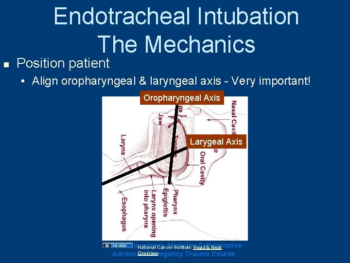 Endotracheal Intubation The Mechanics n Position patient • Align oropharyngeal & laryngeal axis - Endotracheal Intubation The Mechanics n Position patient • Align oropharyngeal & laryngeal axis -