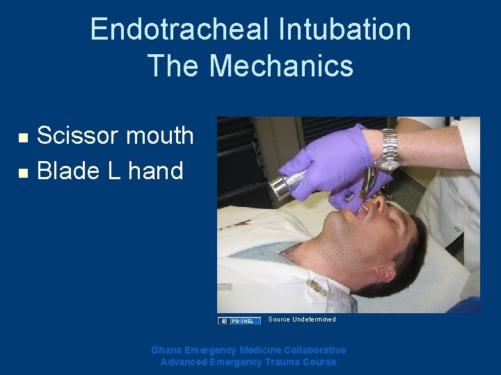 Endotracheal Intubation The Mechanics Scissor mouth n Blade L hand n Source Undetermined Ghana Endotracheal Intubation The Mechanics Scissor mouth n Blade L hand n Source Undetermined Ghana