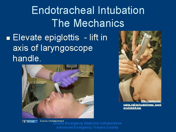 Endotracheal Intubation The Mechanics n Elevate epiglottis - lift in axis of laryngoscope handle. Endotracheal Intubation The Mechanics n Elevate epiglottis - lift in axis of laryngoscope handle.