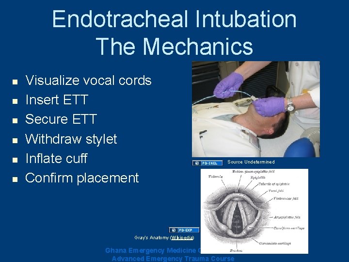 Endotracheal Intubation The Mechanics n n n Visualize vocal cords Insert ETT Secure ETT Endotracheal Intubation The Mechanics n n n Visualize vocal cords Insert ETT Secure ETT