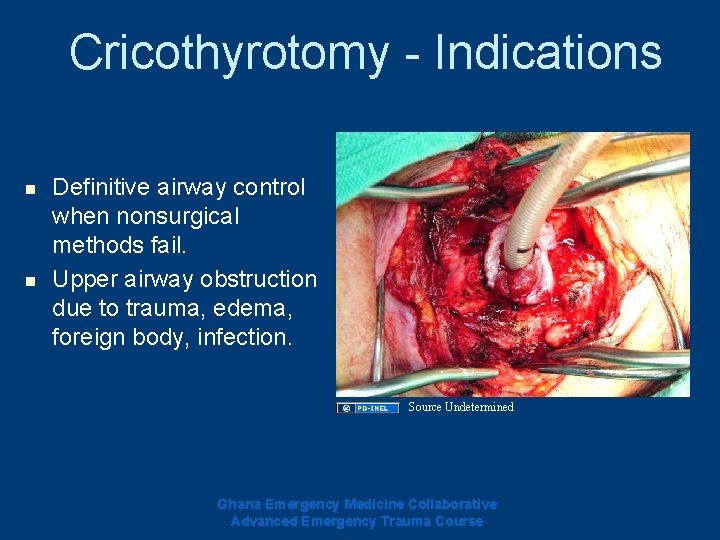 Cricothyrotomy - Indications n n Definitive airway control when nonsurgical methods fail. Upper airway Cricothyrotomy - Indications n n Definitive airway control when nonsurgical methods fail. Upper airway