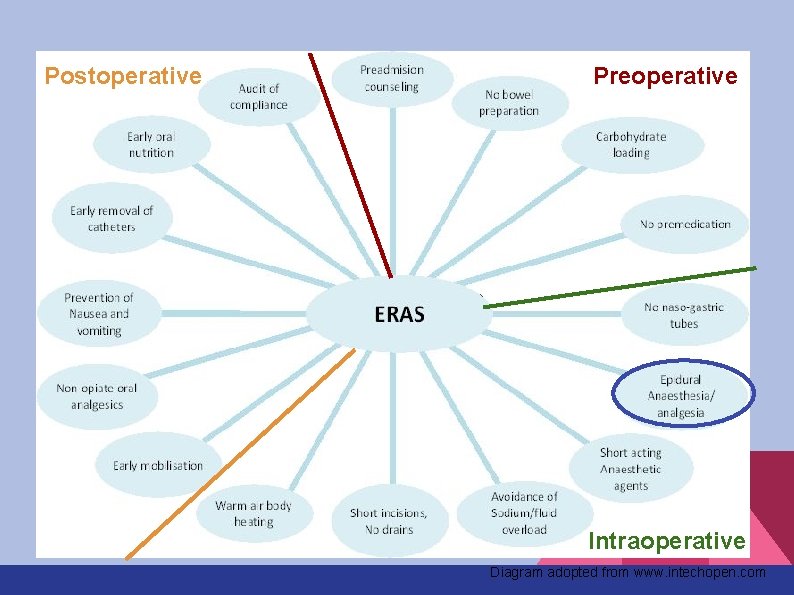 Postoperative Preoperative Intraoperative Diagram adopted from www. intechopen. com 