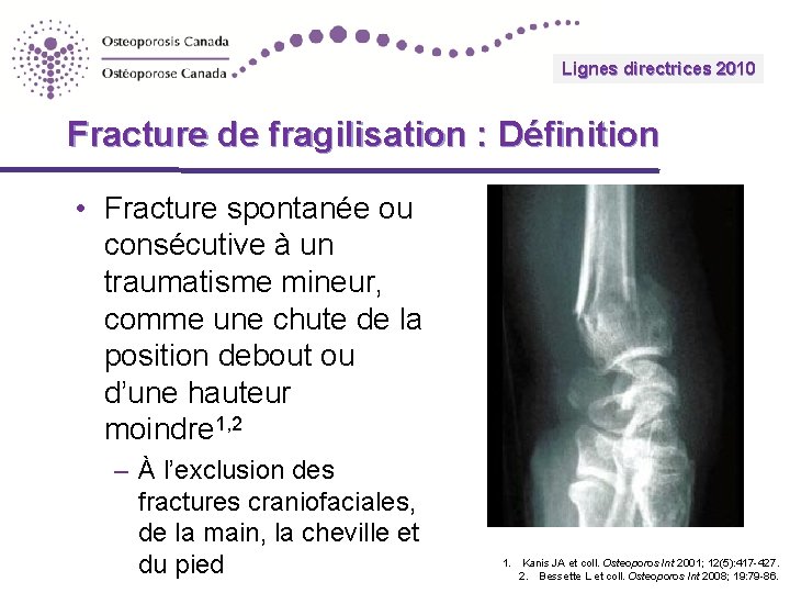 Lignes directrices 2010 Guidelines Fracture de fragilisation : Définition • Fracture spontanée ou consécutive