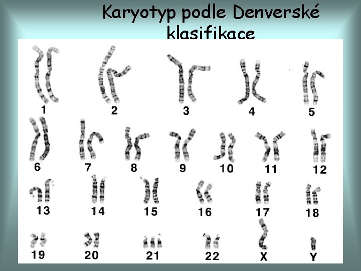 Karyotyp podle Denverské klasifikace 