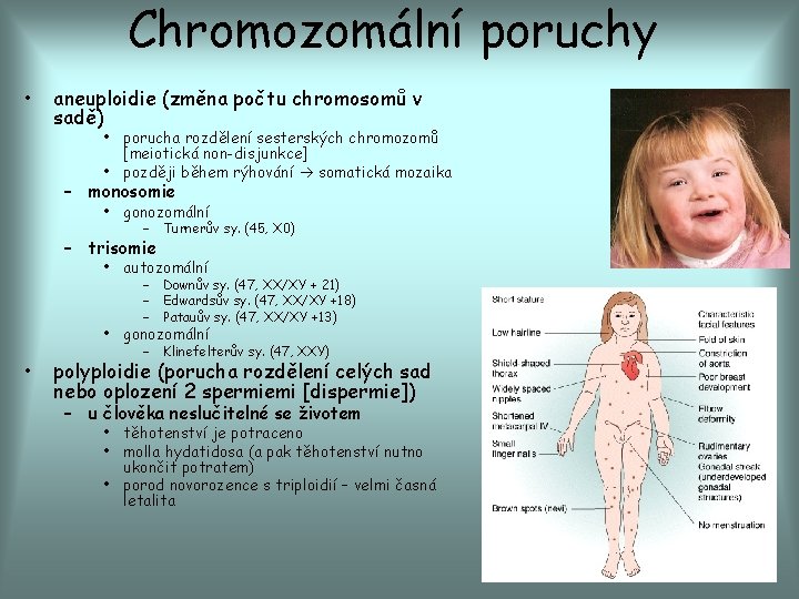 Chromozomální poruchy • aneuploidie (změna počtu chromosomů v sadě) • porucha rozdělení sesterských chromozomů