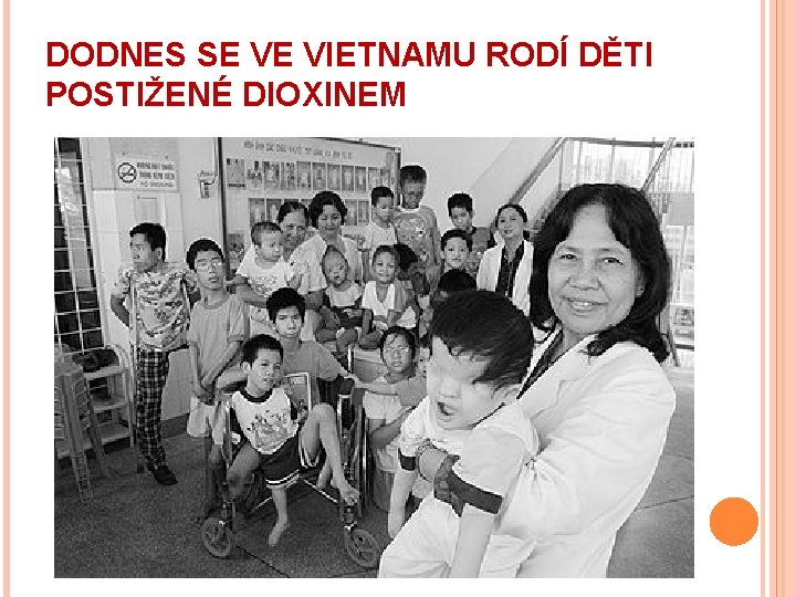 DODNES SE VE VIETNAMU RODÍ DĚTI POSTIŽENÉ DIOXINEM 