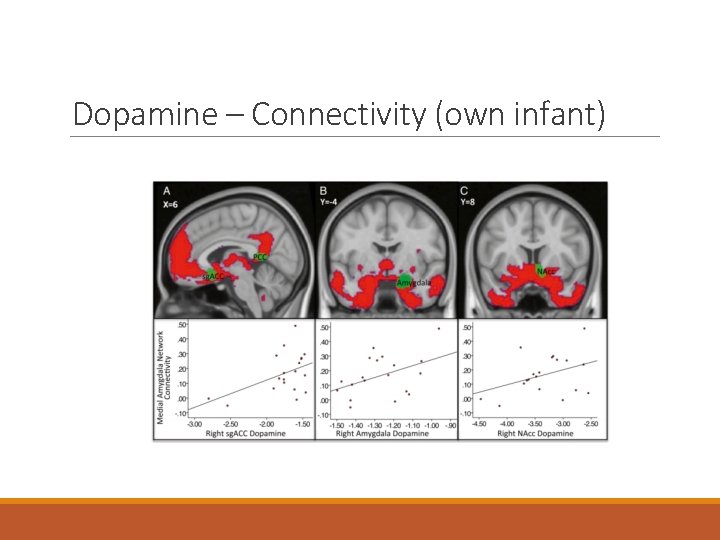 Dopamine – Connectivity (own infant) Dopamine – Connectivity (own infant)