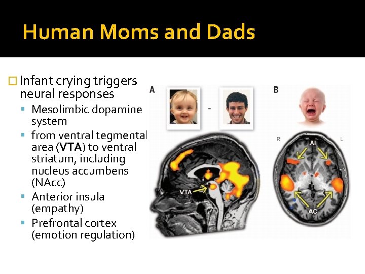 Human Moms and Dads � Infant crying triggers neural responses Mesolimbic dopamine system from Human Moms and Dads � Infant crying triggers neural responses Mesolimbic dopamine system from