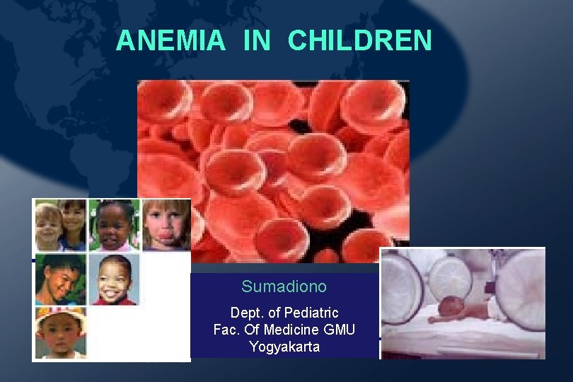 ANEMIA IN CHILDREN Sumadiono Dept. of Pediatric Fac. Of Medicine GMU Yogyakarta ANEMIA IN CHILDREN Sumadiono Dept. of Pediatric Fac. Of Medicine GMU Yogyakarta