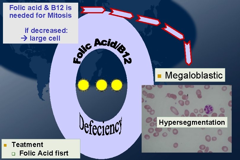 Folic acid & B 12 is needed for Mitosis if decreased: large cell Megaloblastic Folic acid & B 12 is needed for Mitosis if decreased: large cell Megaloblastic