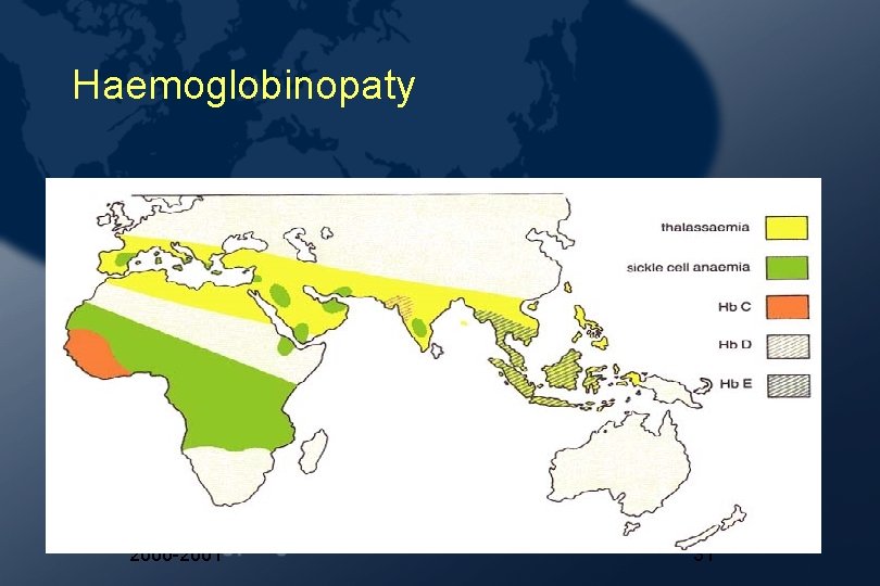 Haemoglobinopaty 2000 -2001 31 Haemoglobinopaty 2000 -2001 31
