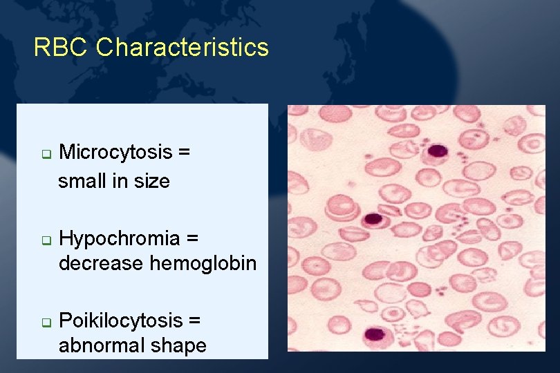 RBC Characteristics Microcytosis = small in size Hypochromia = decrease hemoglobin Poikilocytosis = abnormal RBC Characteristics Microcytosis = small in size Hypochromia = decrease hemoglobin Poikilocytosis = abnormal
