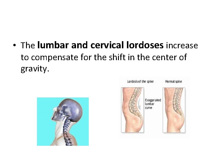  • The lumbar and cervical lordoses increase to compensate for the shift in