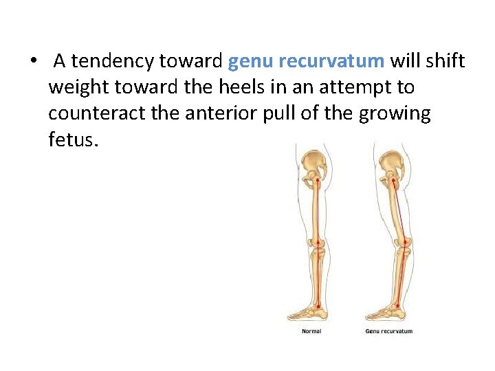  • A tendency toward genu recurvatum will shift weight toward the heels in