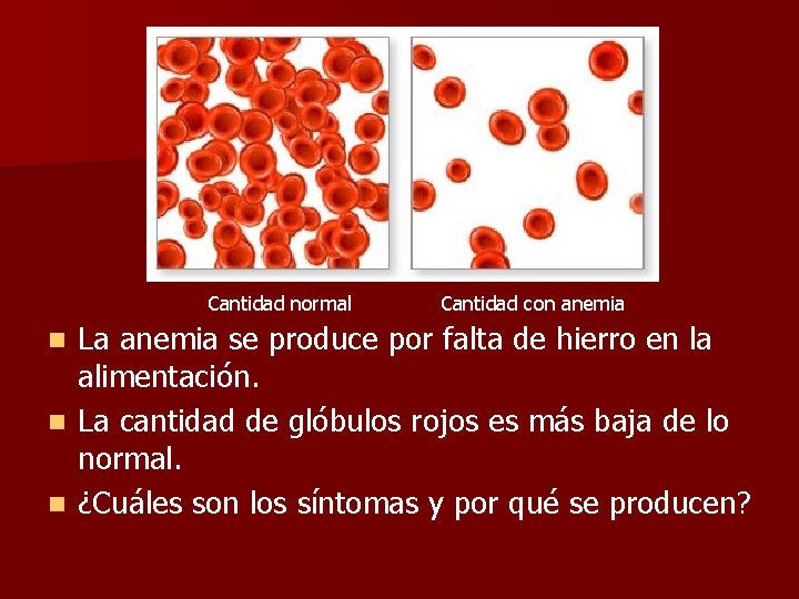 Cantidad normal Cantidad con anemia La anemia se produce por falta de hierro en