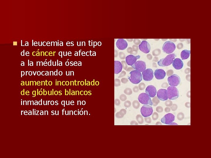 n La leucemia es un tipo de cáncer que afecta a la médula ósea