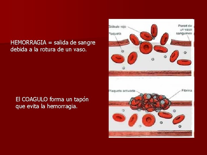 HEMORRAGIA = salida de sangre debida a la rotura de un vaso. El COAGULO
