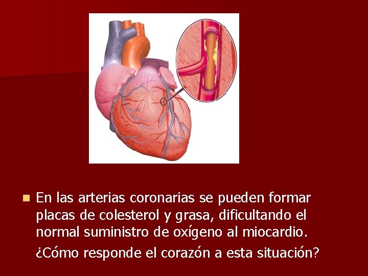 n En las arterias coronarias se pueden formar placas de colesterol y grasa, dificultando