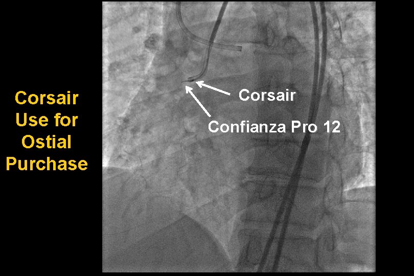 Corsair Use for Ostial Purchase Corsair Confianza Pro 12 