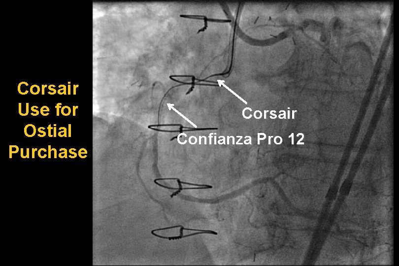 Corsair Use for Ostial Purchase Corsair Confianza Pro 12 