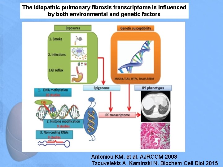 The Idiopathic pulmonary fibrosis transcriptome is influenced by both environmental and genetic factors Antoniou