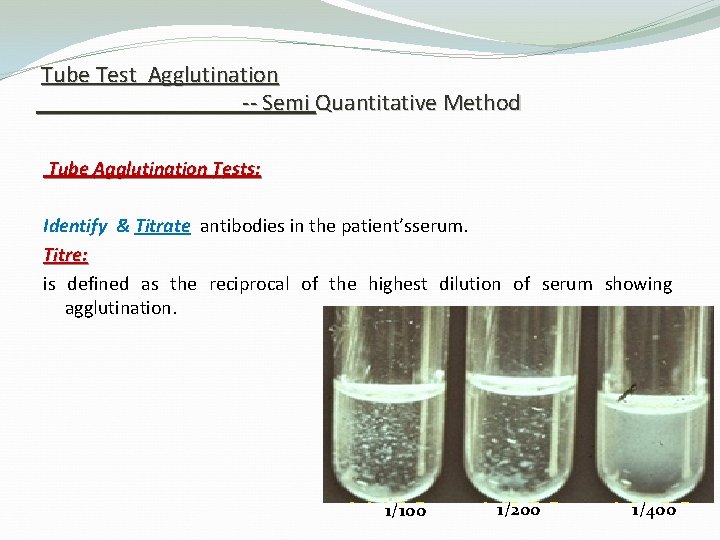 Tube Test Agglutination -- Semi Quantitative Method Tube Agglutination Tests: Identify & Titrate antibodies Tube Test Agglutination -- Semi Quantitative Method Tube Agglutination Tests: Identify & Titrate antibodies