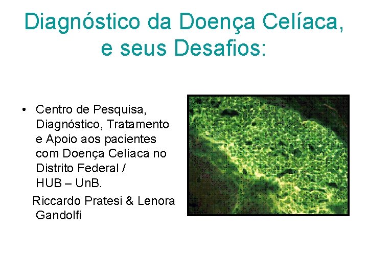 Diagnóstico da Doença Celíaca, e seus Desafios: • Centro de Pesquisa, Diagnóstico, Tratamento e Diagnóstico da Doença Celíaca, e seus Desafios: • Centro de Pesquisa, Diagnóstico, Tratamento e