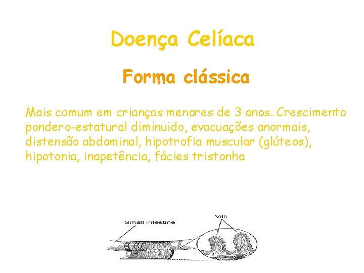 Doença Celíaca Forma clássica Mais comum em crianças menores de 3 anos. Crescimento pondero-estatural Doença Celíaca Forma clássica Mais comum em crianças menores de 3 anos. Crescimento pondero-estatural