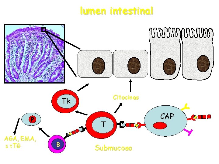 lumen intestinal Citocinas Tk P AGA, EMA, e t. TG T B Submucosa CAP lumen intestinal Citocinas Tk P AGA, EMA, e t. TG T B Submucosa CAP