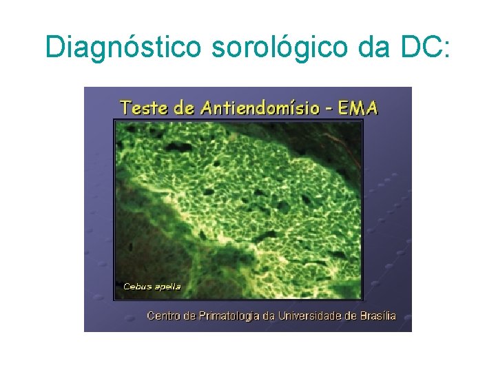 Diagnóstico sorológico da DC: Diagnóstico sorológico da DC: