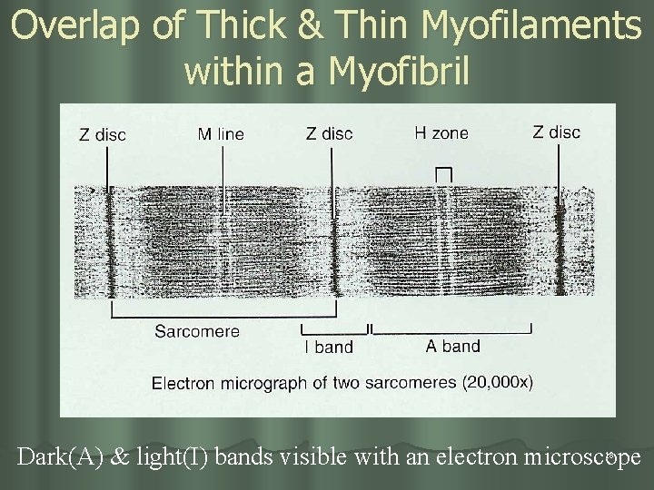 Overlap of Thick & Thin Myofilaments within a Myofibril Dark(A) & light(I) bands visible