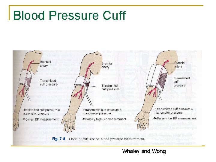 Blood Pressure Cuff Whaley and Wong 