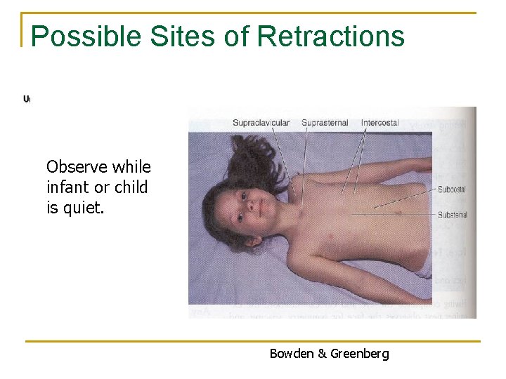 Possible Sites of Retractions Observe while infant or child is quiet. Bowden & Greenberg