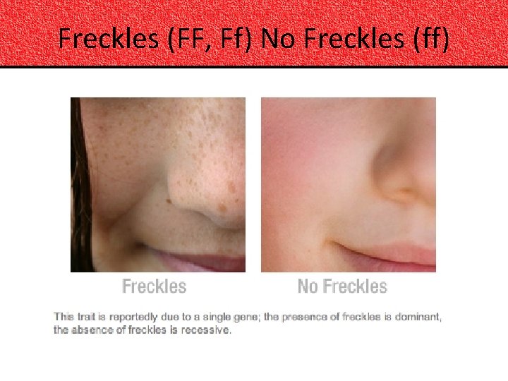 Freckles (FF, Ff) No Freckles (ff) 