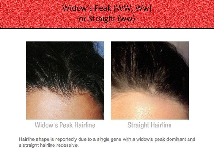 Widow’s Peak (WW, Ww) or Straight (ww) 