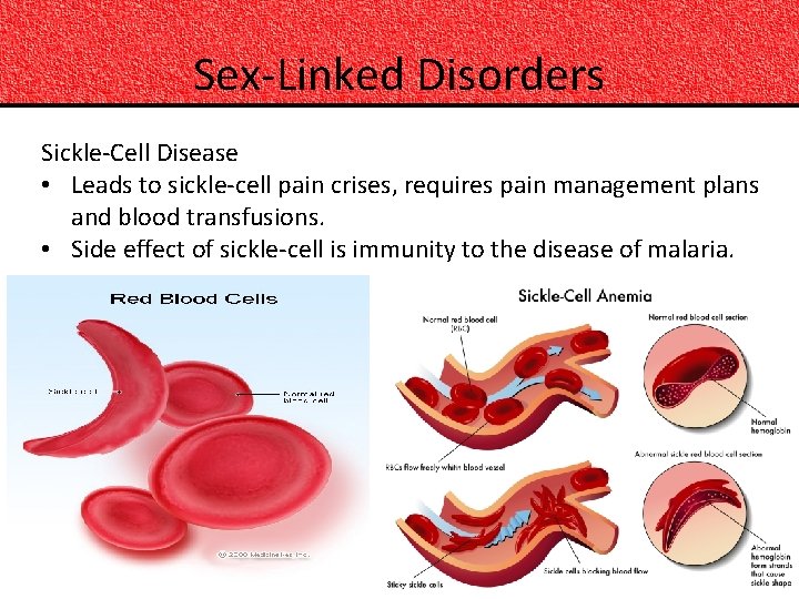 Sex-Linked Disorders Sickle-Cell Disease • Leads to sickle-cell pain crises, requires pain management plans