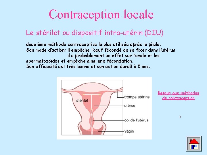 Contraception locale Le stérilet ou dispositif intra-utérin (DIU) deuxième méthode contraceptive la plus utilisée Contraception locale Le stérilet ou dispositif intra-utérin (DIU) deuxième méthode contraceptive la plus utilisée