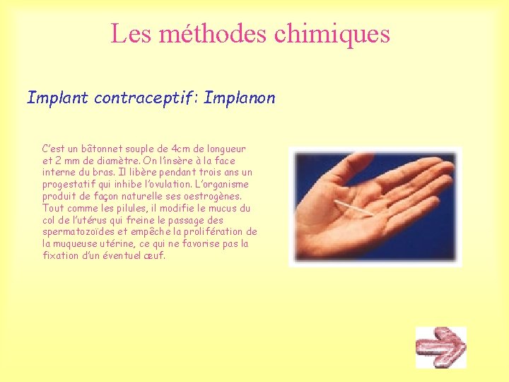 Les méthodes chimiques Implant contraceptif: Implanon C’est un bâtonnet souple de 4 cm de Les méthodes chimiques Implant contraceptif: Implanon C’est un bâtonnet souple de 4 cm de