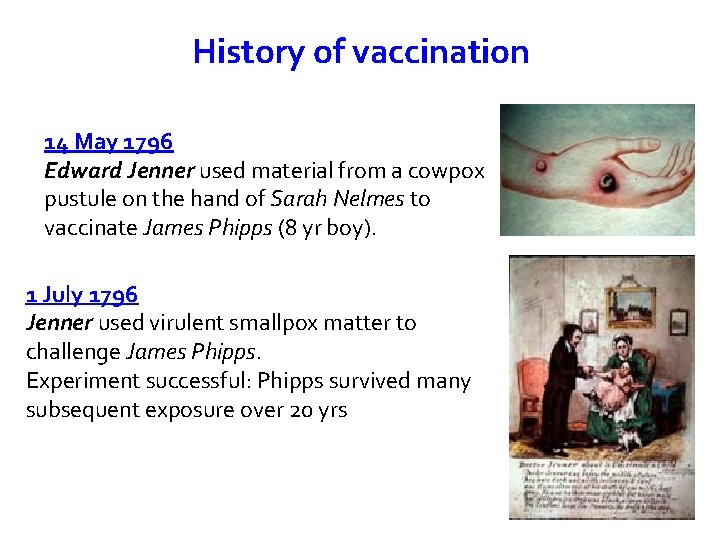 History of vaccination 14 May 1796 Edward Jenner used material from a cowpox pustule