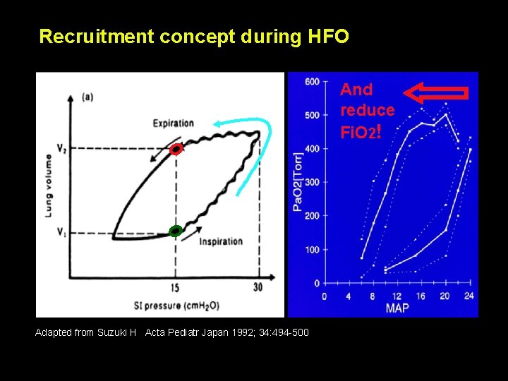 Recruitment concept during HFO And reduce Fi. O 2! Adapted from Suzuki H Acta