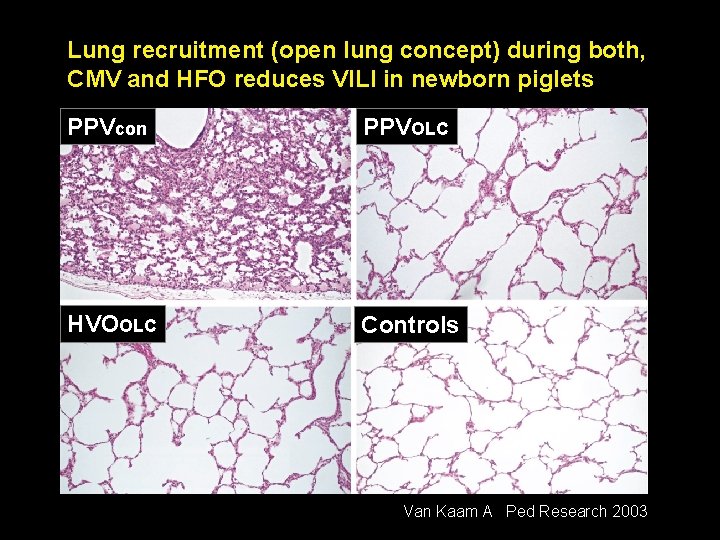 Lung recruitment (open lung concept) during both, CMV and HFO reduces VILI in newborn