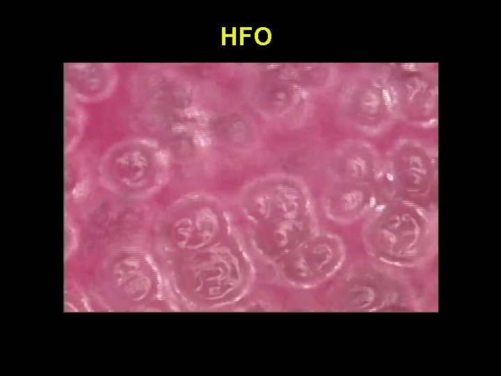 HFO 