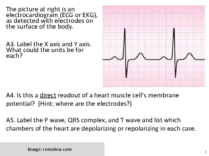 The picture at right is an electrocardiogram (ECG or EKG), as detected with electrodes